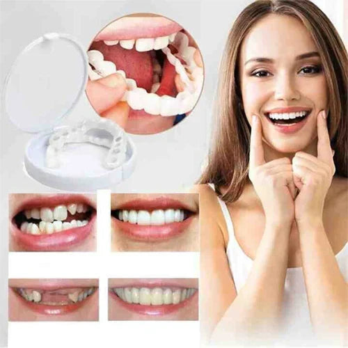 Hollywood smile